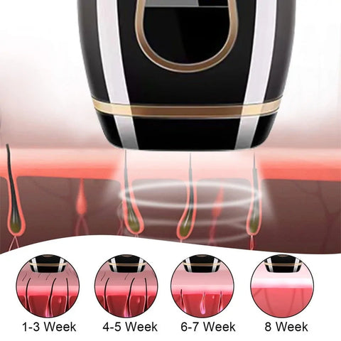 990000 Flash Professional Permanent IPL  Laser Hair Remover Frugal Finds Galore