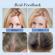 Anti Hair Loss Shampoo Set Frugal Finds Galore