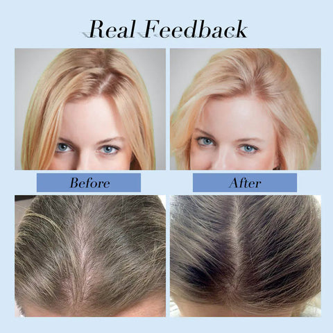 Anti Hair Loss Shampoo Set Frugal Finds Galore