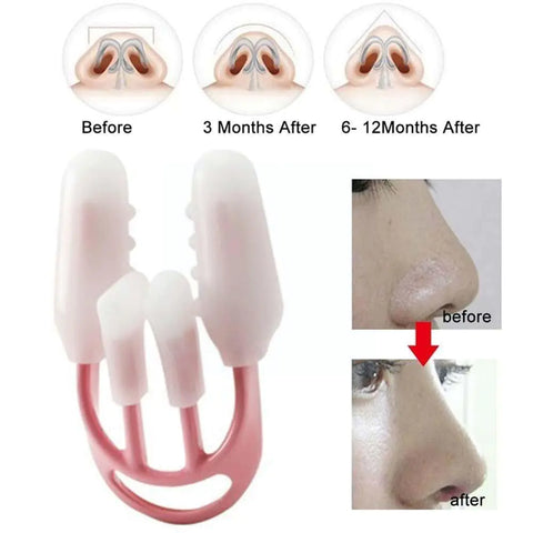 Nose Up Lifting Shaping Orthotic Clip Beauty Tool Frugal Finds Galore