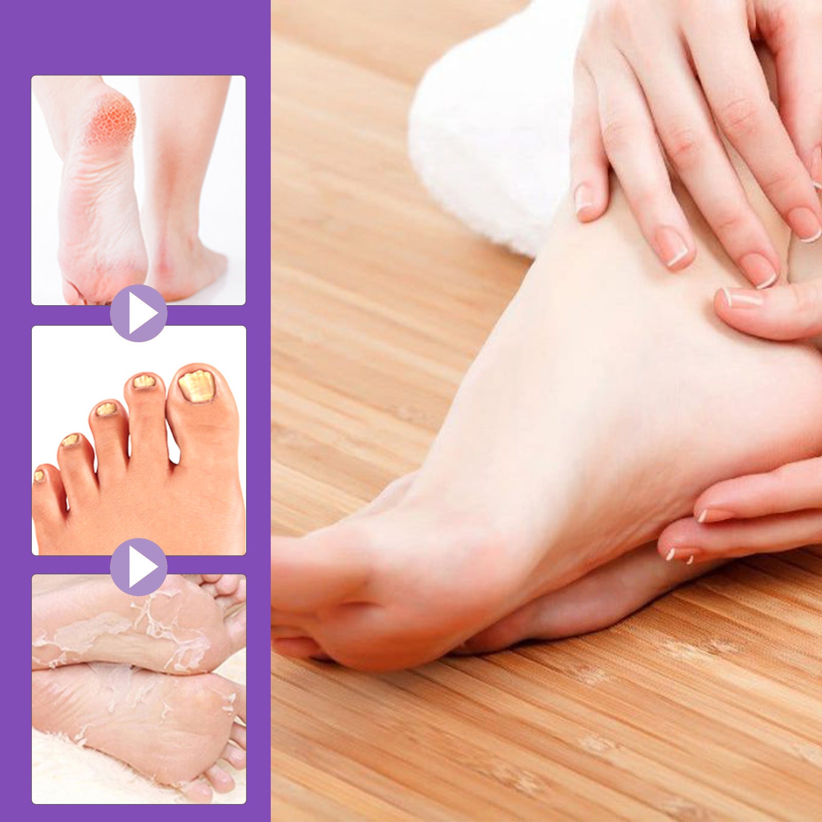 Exfoliating  Foot Mask