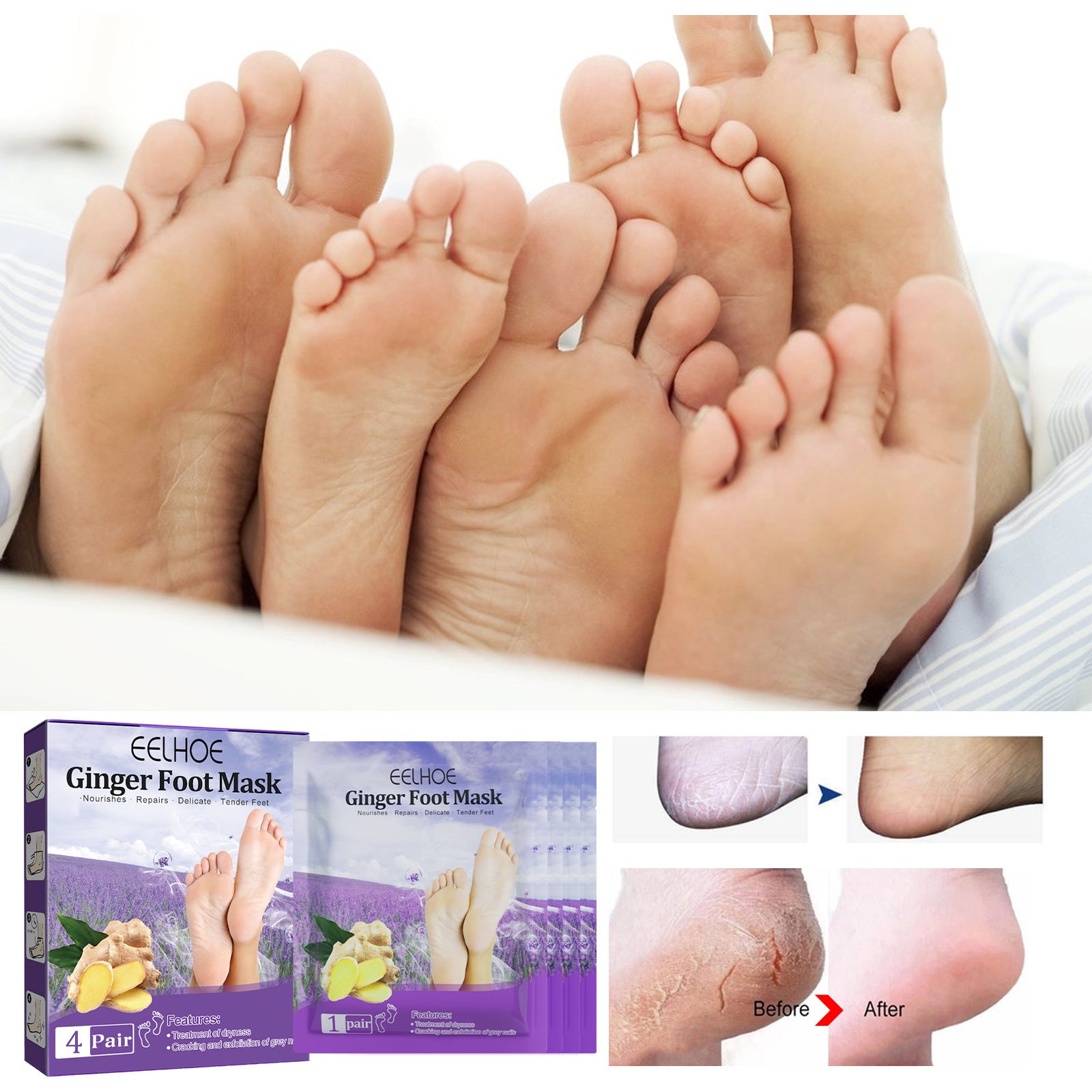 Exfoliating  Foot Mask