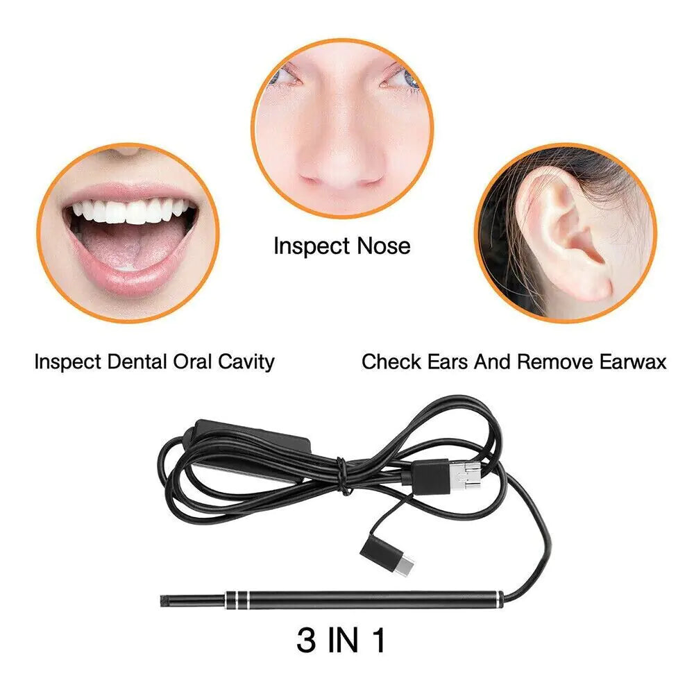 Ear Endoscope