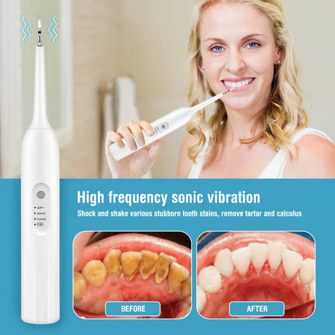 Smart Touch Screen Tooth Cleaner for Home Use Frugal Finds Galore