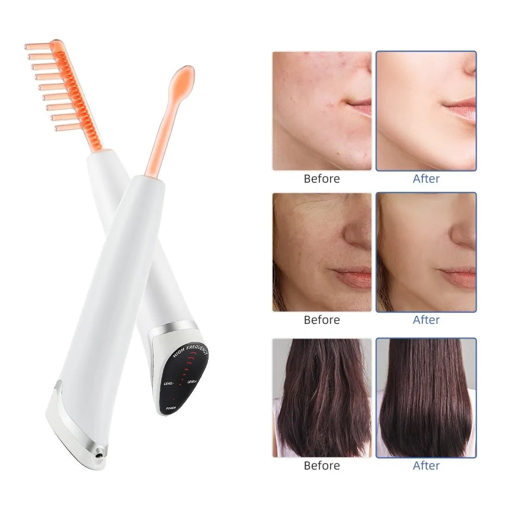 Spot Acne Remover Hair Facial Body