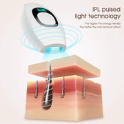 IPL Laser Hair Removal Epilator Original Frugal Finds Galore