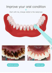 LED Rechargeable Tooth Cleaner with 3 Modes & 2 Heads Frugal Finds Galore
