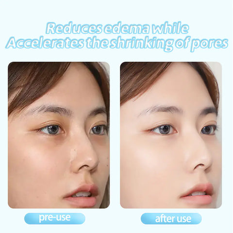 Facial Cooling Ice Hammer for Home Beauty Treatment Frugal Finds Galore